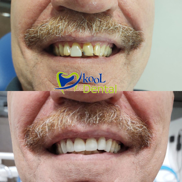 Slider image (8) Kool Dental